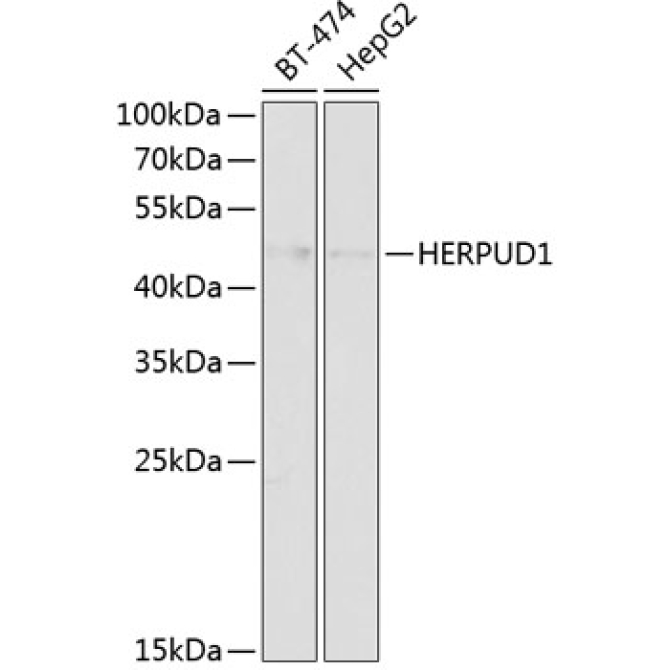 HERPUD1 Rabbit Polyclonal Antibody