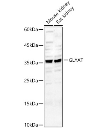 GLYAT Rabbit Polyclonal Antibody