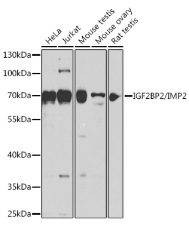 IGF2BP2/IMP2 Rabbit Polyclonal Antibody