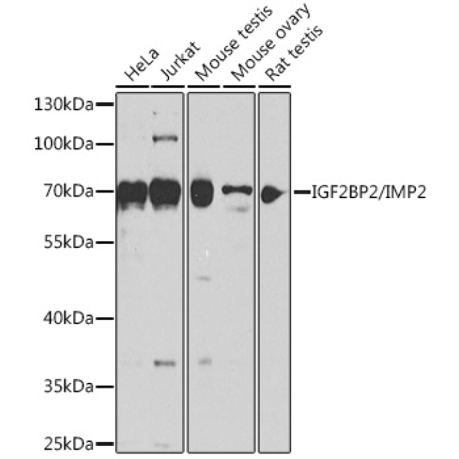 IGF2BP2/IMP2 Rabbit Polyclonal Antibody