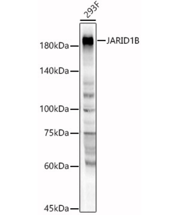 JARID1B Rabbit Polyclonal Antibody