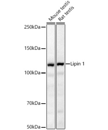 Lipin 1 Rabbit Polyclonal Antibody