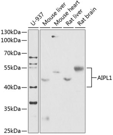 AIPL1 Rabbit Polyclonal Antibody