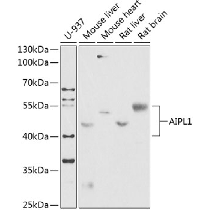 AIPL1 Rabbit Polyclonal Antibody