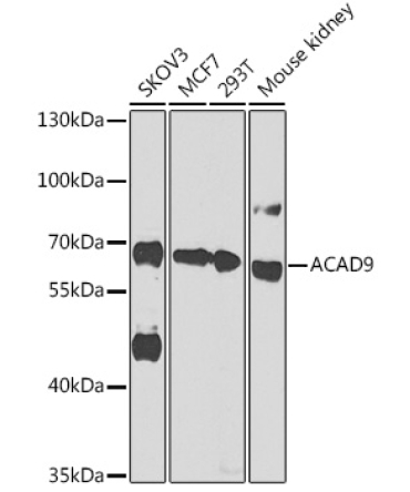 ACAD9 Rabbit Polyclonal Antibody