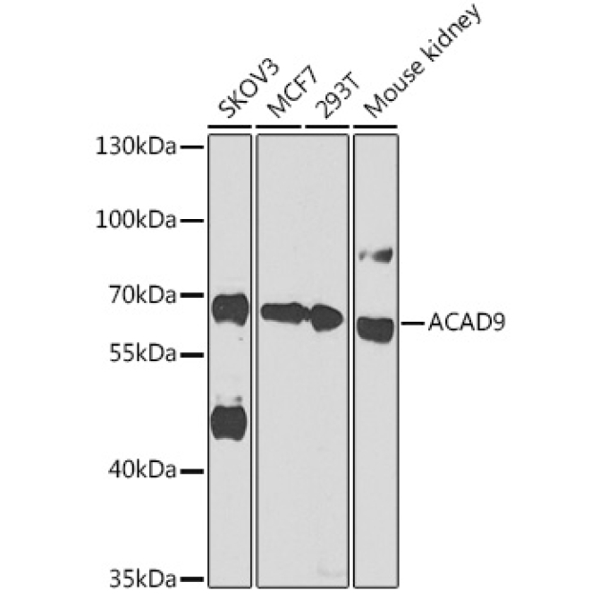 ACAD9 Rabbit Polyclonal Antibody