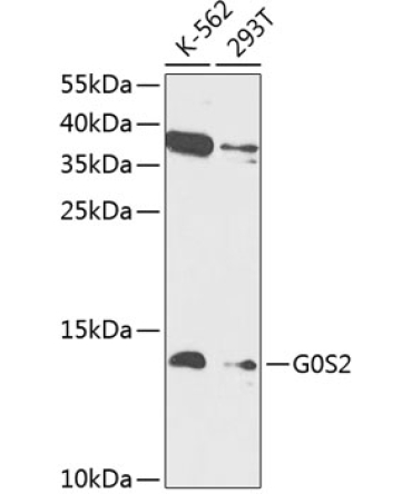 G0S2 Rabbit Polyclonal Antibody