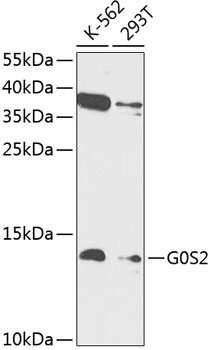 G0S2 Rabbit Polyclonal Antibody