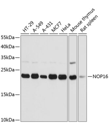 NOP16 Rabbit Polyclonal Antibody