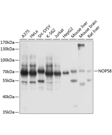 NOP58 Rabbit Polyclonal Antibody