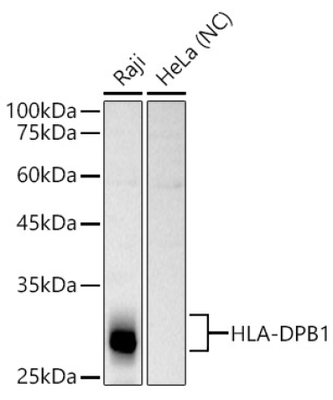 HLA-DPB1 Rabbit Polyclonal Antibody