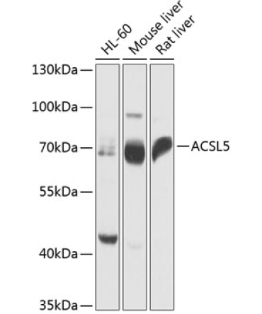 ACSL5 Rabbit Polyclonal Antibody