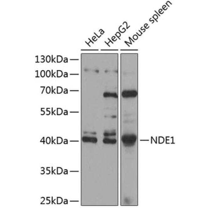 NDE1 Rabbit Polyclonal Antibody