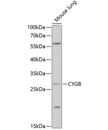 CYGB Rabbit Polyclonal Antibody