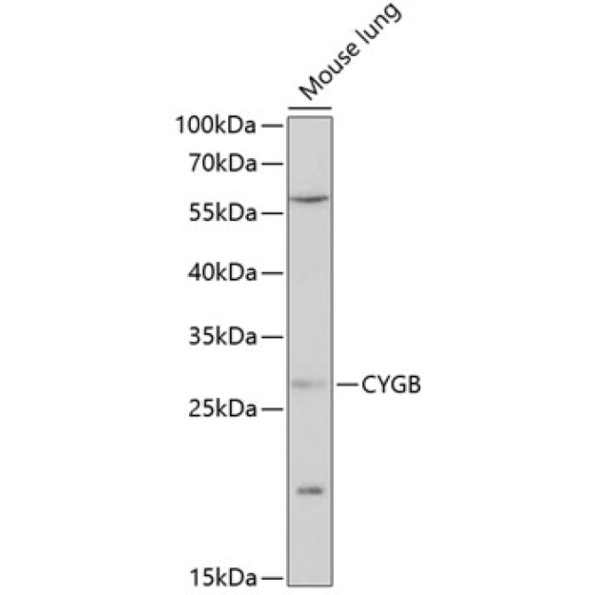 CYGB Rabbit Polyclonal Antibody