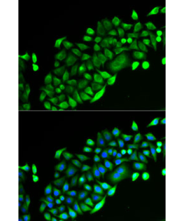 GSTO2 Rabbit Polyclonal Antibody