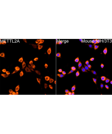 METTL2A Rabbit Polyclonal Antibody
