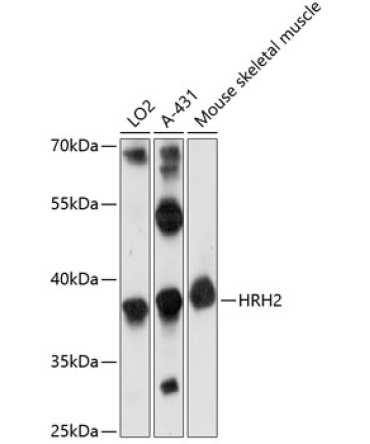 HRH2 Rabbit Polyclonal Antibody