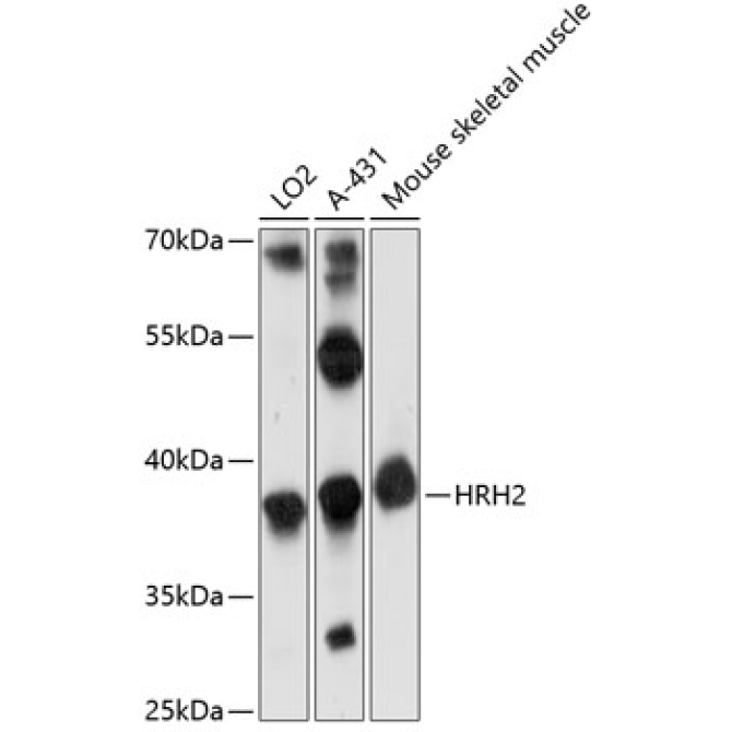 HRH2 Rabbit Polyclonal Antibody