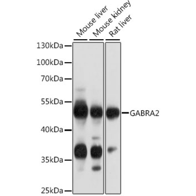GABRA2 Rabbit Polyclonal Antibody
