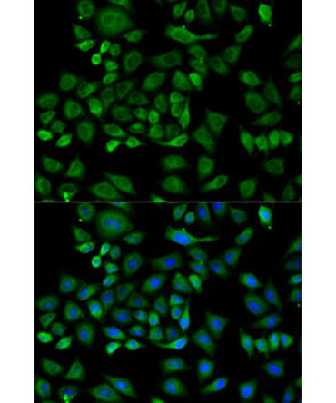 Haptoglobin (HP) Rabbit Polyclonal Antibody