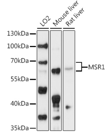 MSR1 Rabbit Polyclonal Antibody