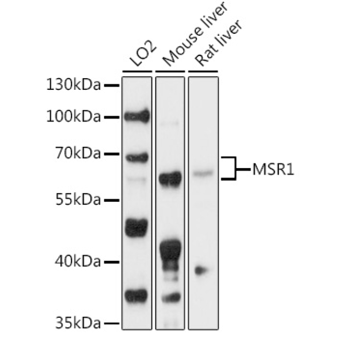 MSR1 Rabbit Polyclonal Antibody