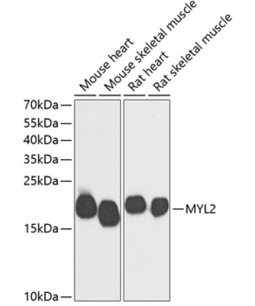 MYL2 Rabbit Polyclonal Antibody