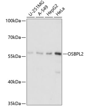 OSBPL2 Rabbit Polyclonal Antibody