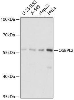 OSBPL2 Rabbit Polyclonal Antibody