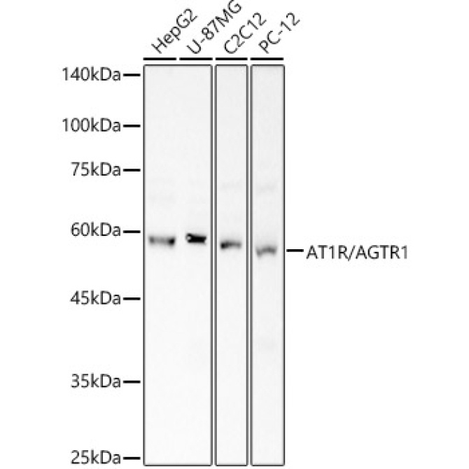 AT1R/AGTR1 Rabbit Polyclonal Antibody