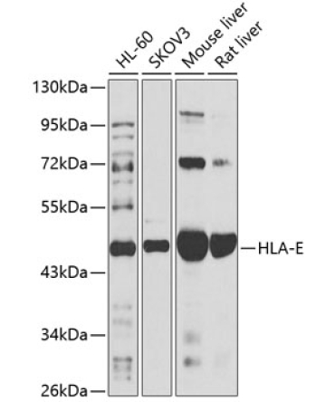 HLA-E Rabbit Polyclonal Antibody