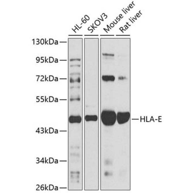 HLA-E Rabbit Polyclonal Antibody