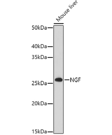 NGF Rabbit Polyclonal Antibody