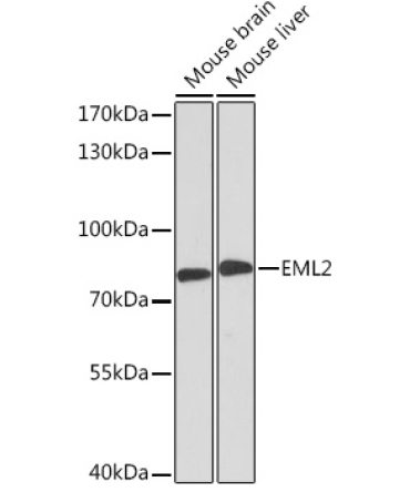 EML2 Rabbit Polyclonal Antibody