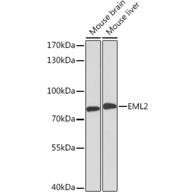 EML2 Rabbit Polyclonal Antibody