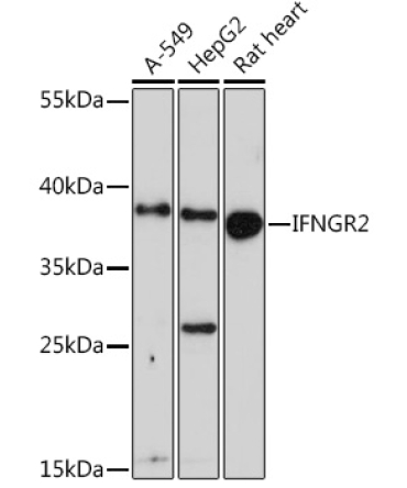 IFNGR2 Rabbit Polyclonal Antibody