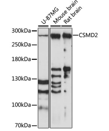 CSMD2 Rabbit Polyclonal Antibody