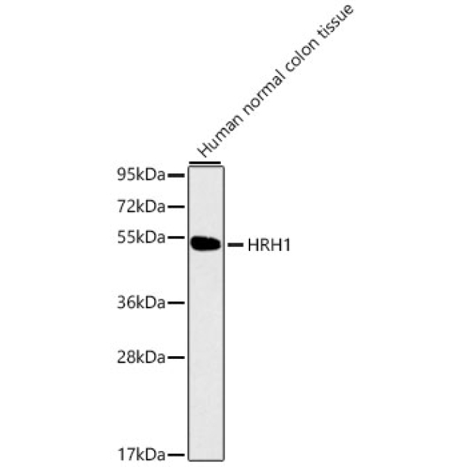HRH1 Rabbit Polyclonal Antibody