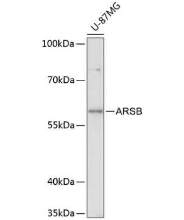 ARSB Rabbit Polyclonal Antibody