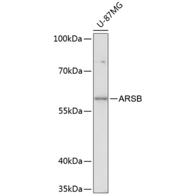 ARSB Rabbit Polyclonal Antibody