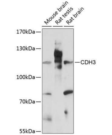 CDH3 Rabbit Polyclonal Antibody