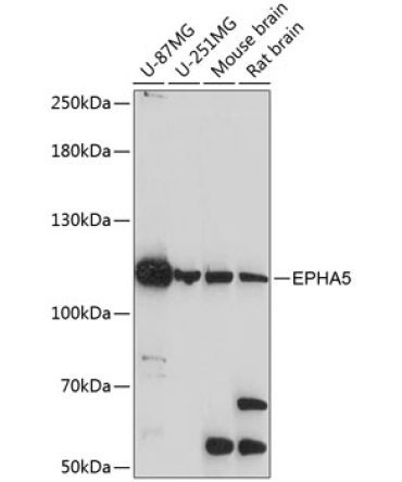 EPHA5 Rabbit Polyclonal Antibody