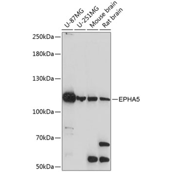 EPHA5 Rabbit Polyclonal Antibody