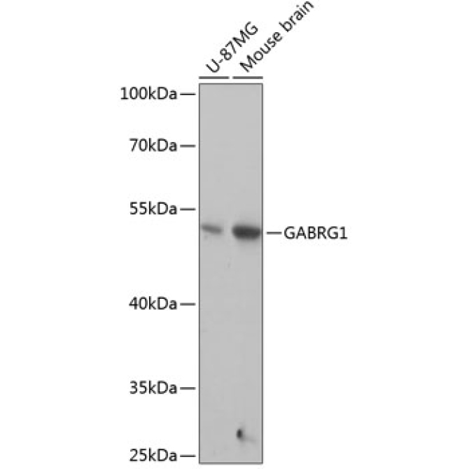GABRG1 Rabbit Polyclonal Antibody