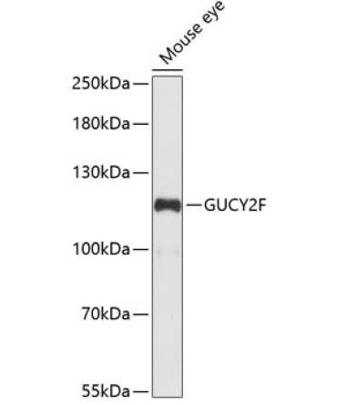 GUCY2F Rabbit Polyclonal Antibody