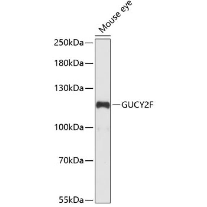 GUCY2F Rabbit Polyclonal Antibody