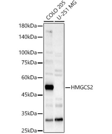 HMGCS2 Rabbit Polyclonal Antibody