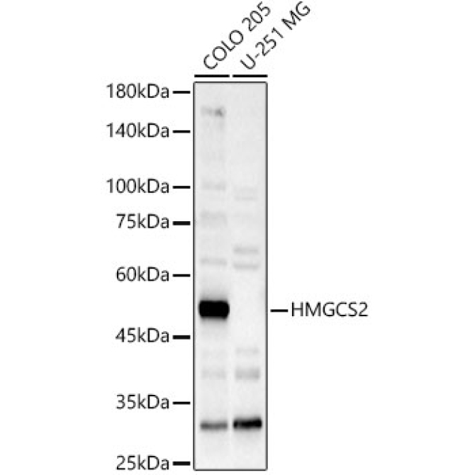 HMGCS2 Rabbit Polyclonal Antibody