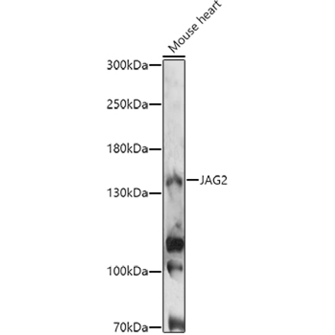 JAG2 Rabbit Polyclonal Antibody